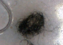 Everyone has This Just how bad – Morgellons Decease – The silent pandemic – Aspergillus Fumigatus